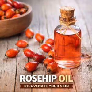 Rosehip oil illustration with a bottle and red rose hips